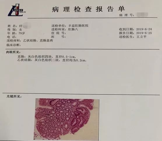 直肠息肉活检报告图片图片